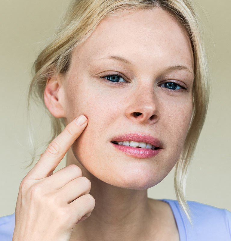 Frau zeigt auf ihre Haut